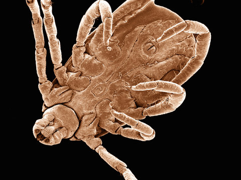 Ventral surface of a dog tick (Acari: Dermacentor sp.)  imaged in a scanning electron microscope
