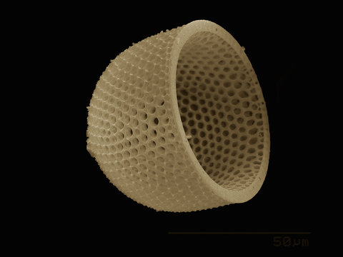The test of a diatom imaged in a scanning electron microscope