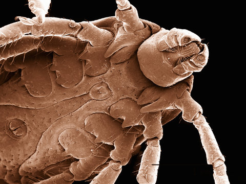 Ventral surface of a dog tick (Acari: Dermacentor sp.) imaged in a scanning electron microscope