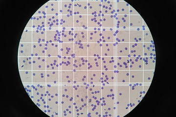 Blood cells on the scale counting chamber