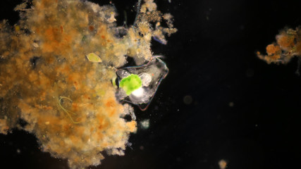 Organism or Protozoa under the microscope view.