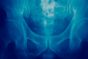 Close up bone  x-ray