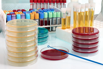 workbench with biological samples on the microbiology laboratory