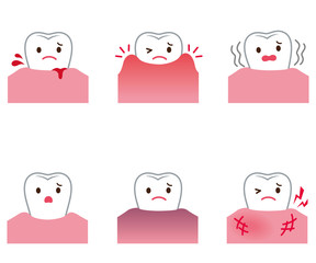 歯の病気　虫歯　歯周病