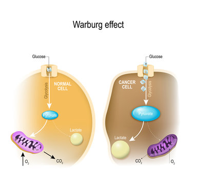 glycolysis. Warburg effect