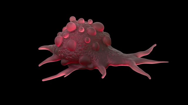 Bladder cancer cell