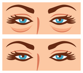 woman eyes before and after cosmetic procedure vector illustration (plastic surgery, rejuvenation treatment)