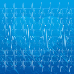 Medical illustration of heartbeat.