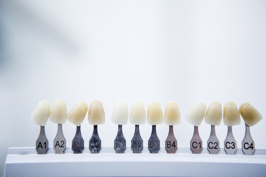 Teeth whitening, samplers of color shades