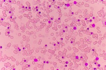 Blood smear