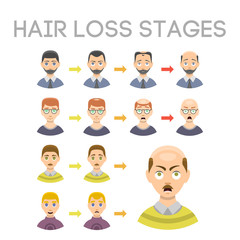 Information chart of hair loss stages types of baldness illustrated on male head vector.