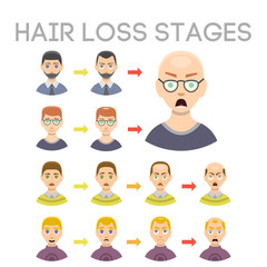 Information chart of hair loss stages types of baldness illustrated on male head vector.