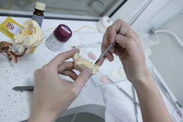 Artificial teeth, dentures, hands at work on the prosthesis