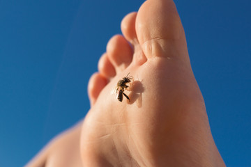 Achtung: Biene auf Fuß, Vorsicht vor Stich / Stichen! Bienensterben 