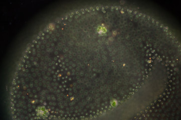 Volvox in drop of water under the microscopic view