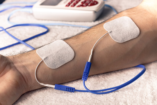 Electroestimulacion deportiva del dolor de antebrazo