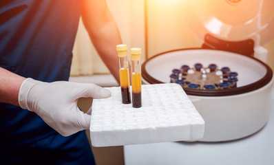 Platelet-Rich plasma preparation. Tube with blood in hands. Centrifuge.