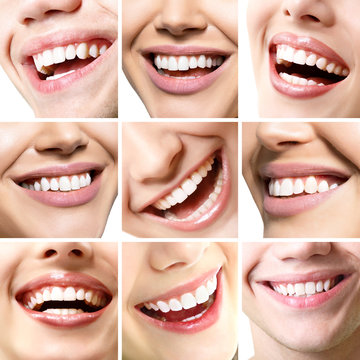 Smiles set. Perfect wide smiles of young people with great healthy white teeth, isolated. Dental care, whitening, stomatology, restoration of teeth, prosthetics, oral hygiene concept.