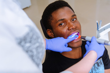 Tooth filling ultraviolet lamp