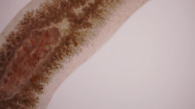 Planaria flatworm under microscope view.
