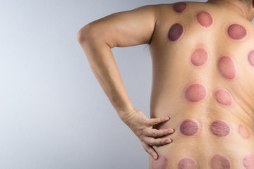 A man back with blood marks massaged