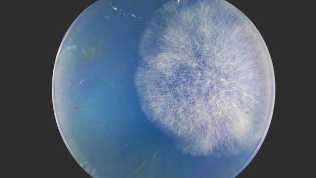 Growing mushrooms in a petri dish, Growth Colony Of Microbes And Pathogenic Fungi In Petri Dish