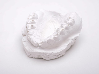 jaw gypsum impression