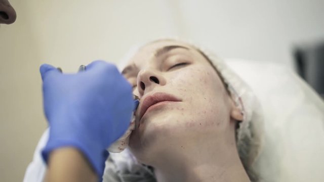 Close up of a cosmetician doing shots near woman s nose and wiping face with a cotton pad. Handheld real time close up shot
