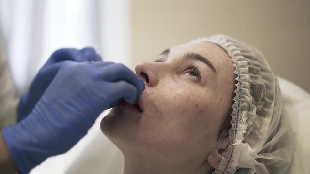 Closeup of cosmetician s hands putting a cotton pad into woman s mouth to stop bleeding after an injection. Handheld real time close up shot