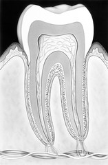 Teeth - Tooth root canal therapy.