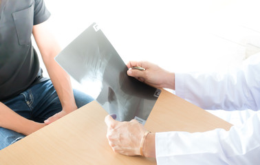 Close up of doctor holding x-ray or film image.