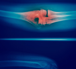 Fototapeta na wymiar Close up bone x-ray
