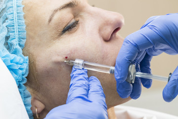 Cosmetic treatment with injection in a clinic