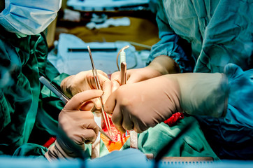 The process of performing cardiac surgery by a surgeon and his assistant. - 153420869