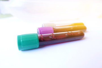 Hand with latex glove holding blood sample