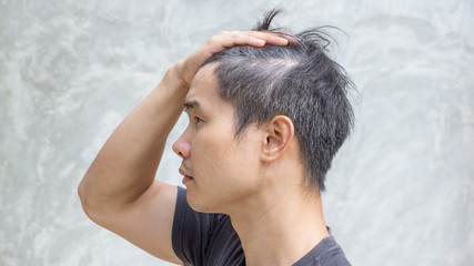 Young asian man has a gray hair.