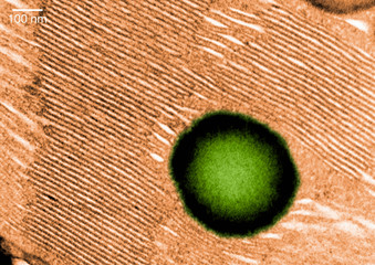 Transmission electron micrograph of a chloroplast