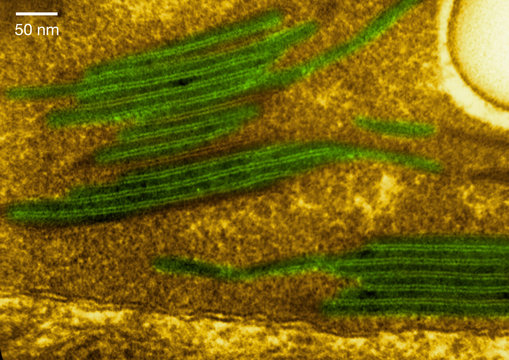 High magnification micrograph of a chloroplast