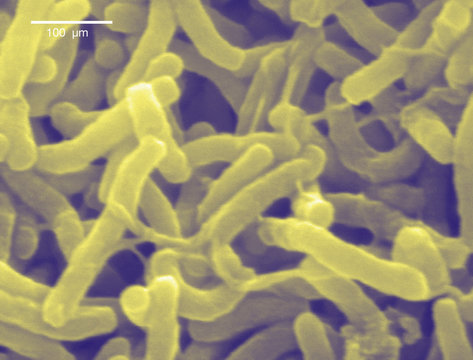 Scanning electron micrograph of Cholera bacteria