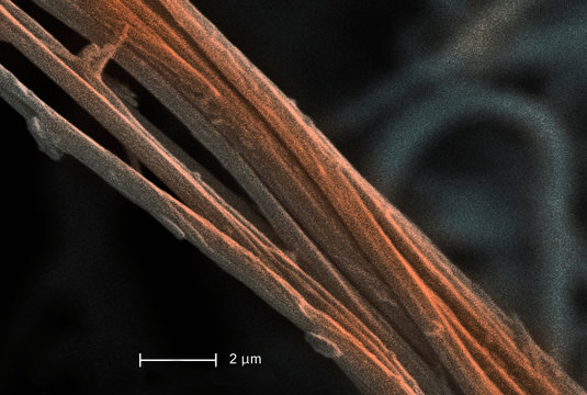 Scanning Electron micrograph of asbestos, 8000x