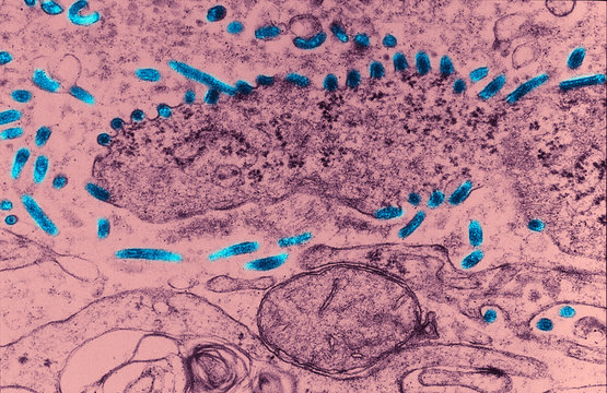 Transmission Electron micrograph of Ebola virus