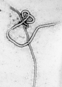 Transmission Electron micrograph of Ebola virus