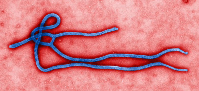 Transmission Electron micrograph of Ebola virus