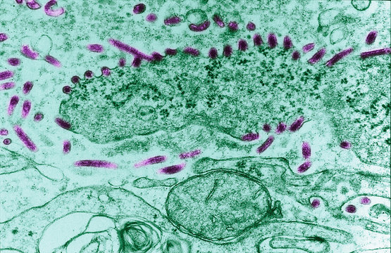 Transmission Electron micrograph of Ebola virus