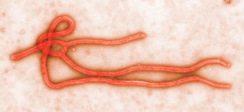 Transmission Electron micrograph of Ebola virus