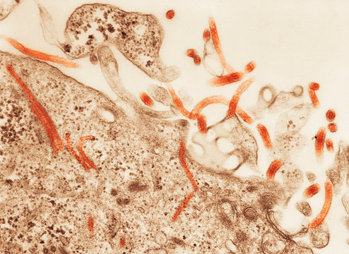 Transmission Electron micrograph of Ebola virus