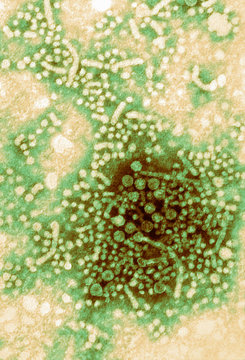 Electron micrograph, hepatitis B virus