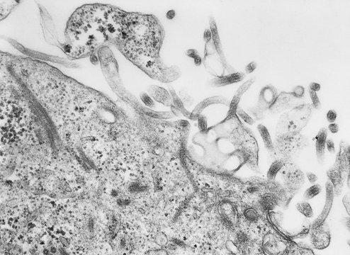 Transmission Electron micrograph of Ebola virus