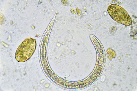 strongyloidosis geohelminth pinworms nagyon hosszú