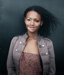 beautiful young brunette woman with vitiligo disease